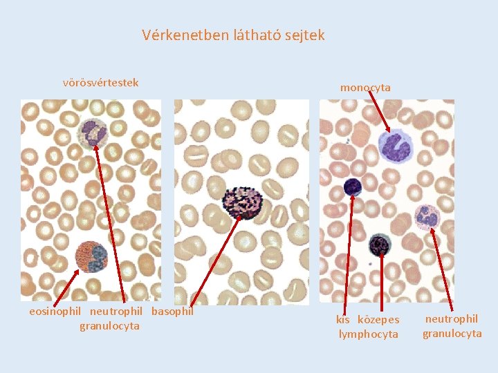 Vérkenetben látható sejtek vörösvértestek eosinophil neutrophil basophil granulocyta monocyta kis közepes lymphocyta neutrophil granulocyta