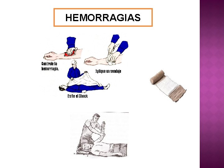 HEMORRAGIAS 