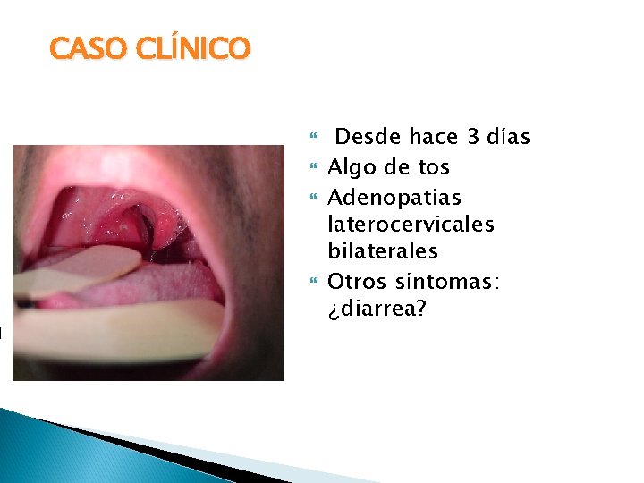 CASO CLÍNICO Desde hace 3 días Algo de tos Adenopatias laterocervicales bilaterales Otros síntomas: