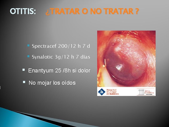 OTITIS: ¿TRATAR O NO TRATAR ? § Spectracef 200/12 h 7 d § Synalotic