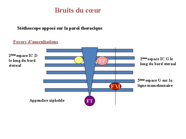 Bruits du cœur Stéthoscope apposé sur la paroi thoracique Foyers d’auscultations 2ème espace IC