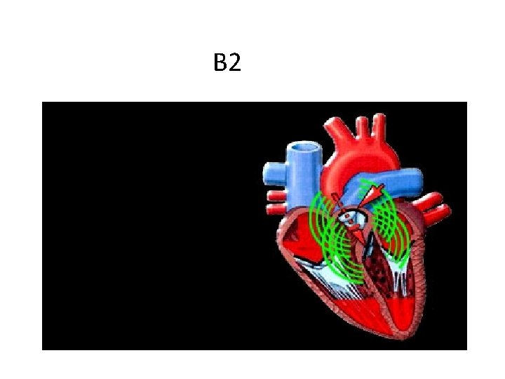B 2 
