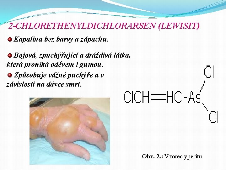 2 -CHLORETHENYLDICHLORARSEN (LEWISIT) Kapalina bez barvy a zápachu. Bojová, zpuchýřující a dráždivá látka, která 2 -CHLORETHENYLDICHLORARSEN (LEWISIT) Kapalina bez barvy a zápachu. Bojová, zpuchýřující a dráždivá látka, která