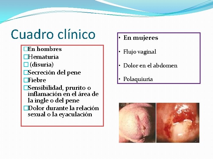 Cuadro clínico �En hombres �Hematuria �(disuria) �Secreción del pene �Fiebre �Sensibilidad, prurito o inflamación