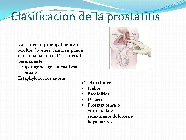 prostatitis aguda agente causal)