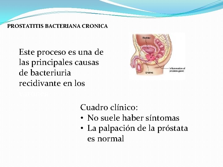 PROSTATITIS BACTERIANA CRONICA Este proceso es una de las principales causas de bacteriuria recidivante