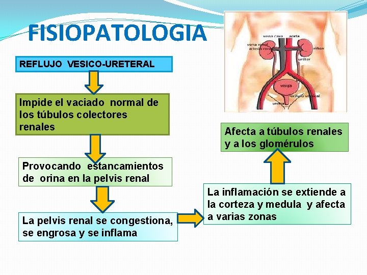 FISIOPATOLOGIA REFLUJO VESICO-URETERAL Impide el vaciado normal de los túbulos colectores renales Afecta a