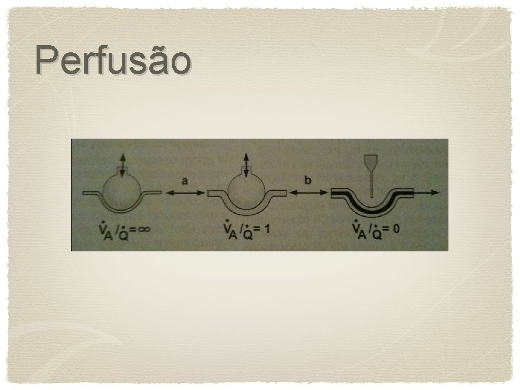 Perfusão 