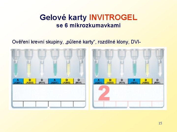 Gelové karty INVITROGEL se 6 mikrozkumavkami Ověření krevní skupiny, „půlené karty“, rozdílné klony, DVI-