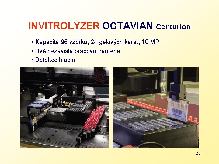 INVITROLYZER OCTAVIAN Centurion • Kapacita 96 vzorků, 24 gelových karet, 10 MP • Dvě