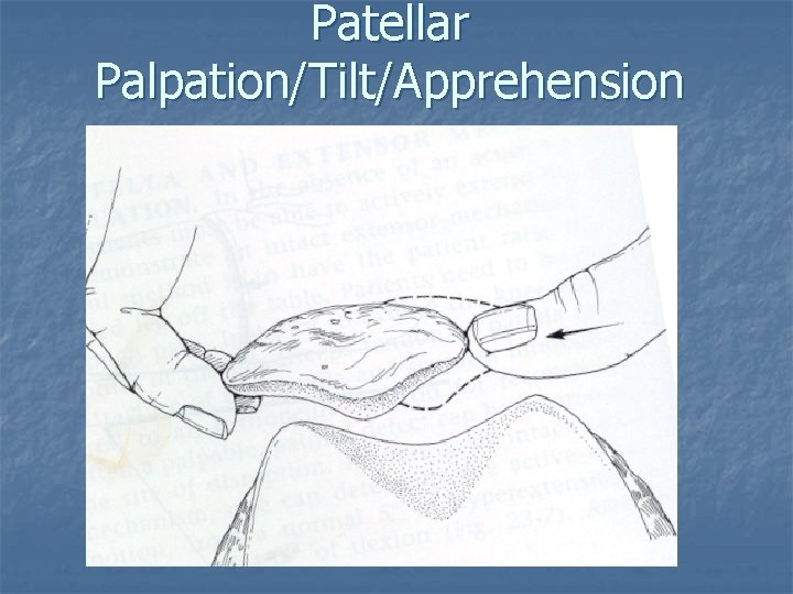 Patellar Palpation/Tilt/Apprehension Patellar Palpation/Tilt/Apprehension