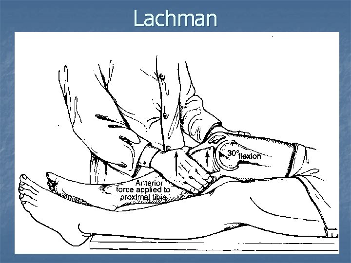 Lachman Lachman