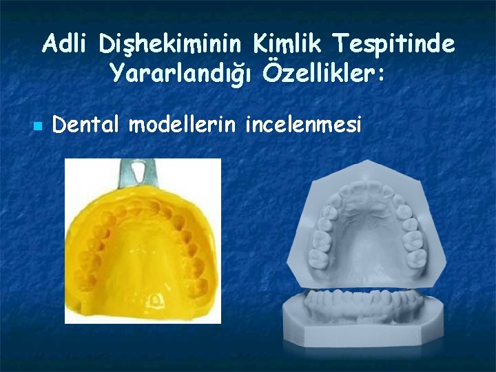 Adli Dişhekiminin Kimlik Tespitinde Yararlandığı Özellikler: n Dental modellerin incelenmesi 