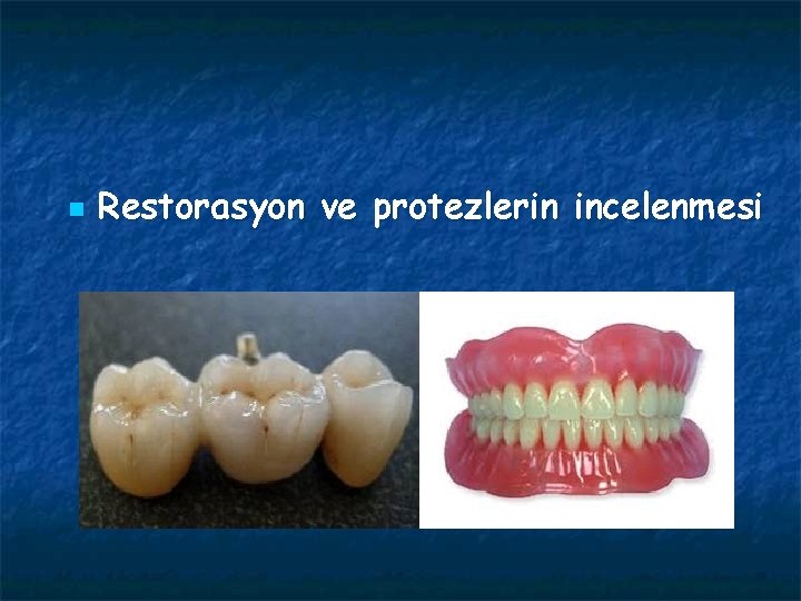 n Restorasyon ve protezlerin incelenmesi 