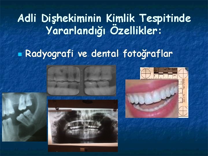 Adli Dişhekiminin Kimlik Tespitinde Yararlandığı Özellikler: n Radyografi ve dental fotoğraflar 