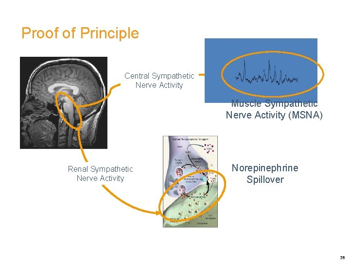 Proof of Principle Central Sympathetic Nerve Activity Muscle Sympathetic Nerve Activity (MSNA) Renal Sympathetic