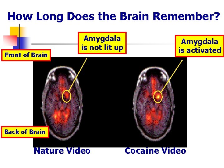 How Long Does the Brain Remember? Front of Brain Amygdala is not lit up