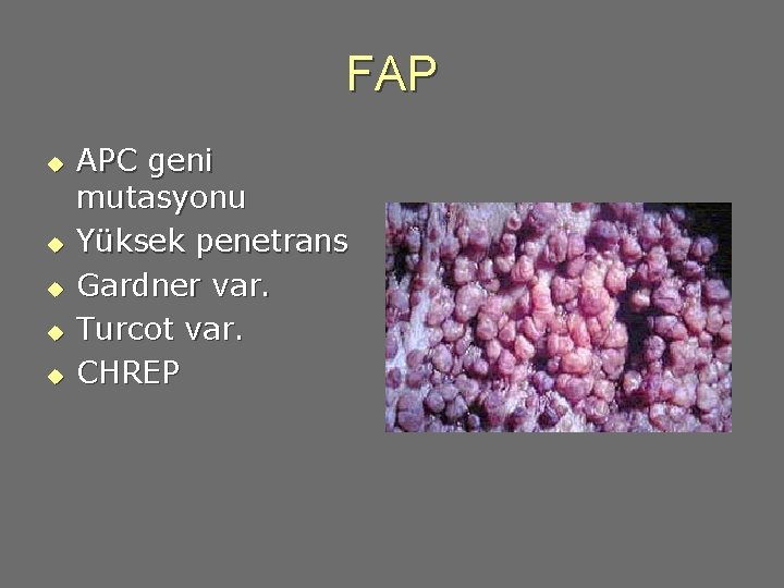 FAP u u u APC geni mutasyonu Yüksek penetrans Gardner var. Turcot var. CHREP