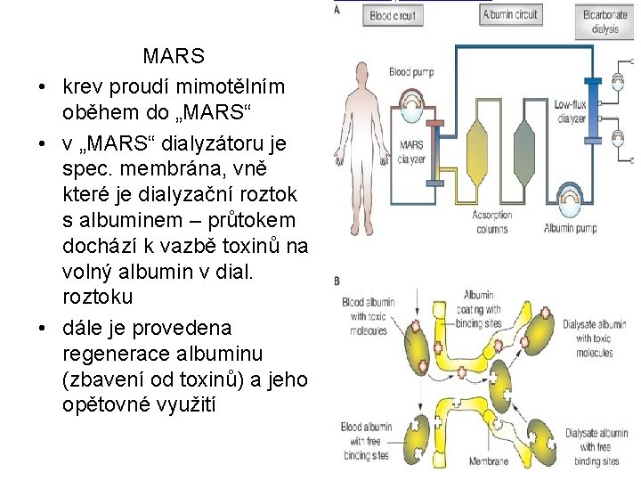 MARS • krev proudí mimotělním oběhem do „MARS“ • v „MARS“ dialyzátoru je spec.