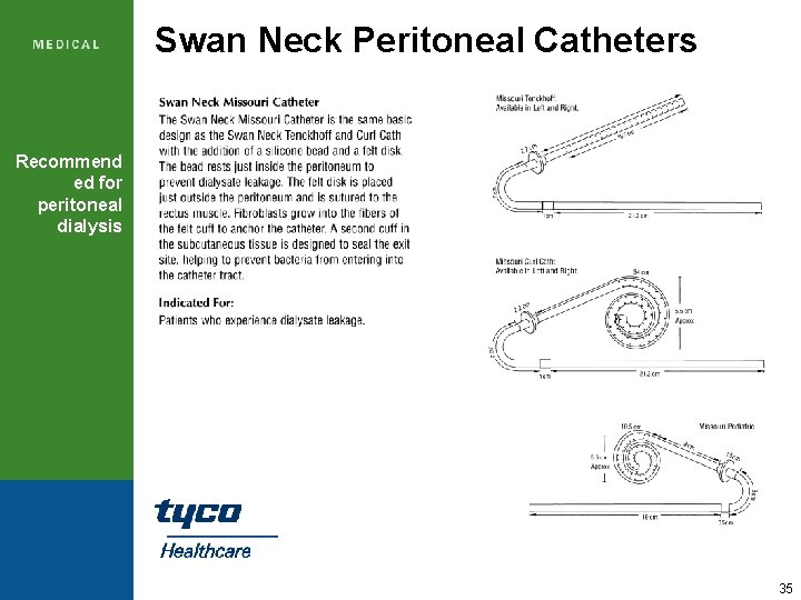 Swan Neck Peritoneal Catheters Recommend ed for peritoneal dialysis 35 