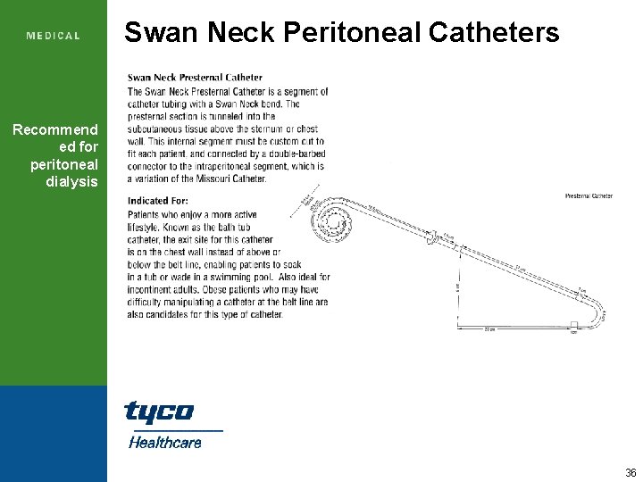 Swan Neck Peritoneal Catheters Recommend ed for peritoneal dialysis 36 