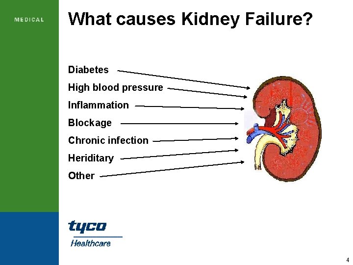 What causes Kidney Failure? Diabetes High blood pressure Inflammation Blockage Chronic infection Heriditary Other