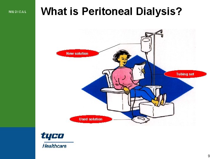 What is Peritoneal Dialysis? New solution Tubing set Used solution 9 
