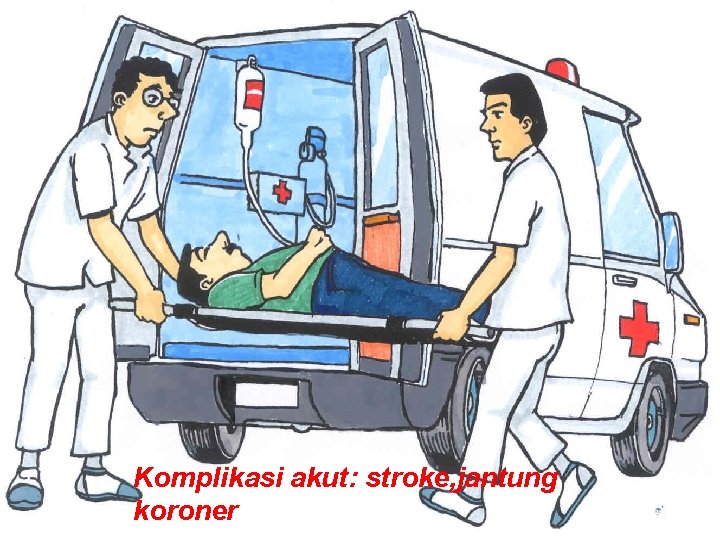 Komplikasi akut: stroke, jantung 51 koroner 