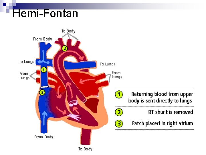 Hemi-Fontan Hemi-Fontan