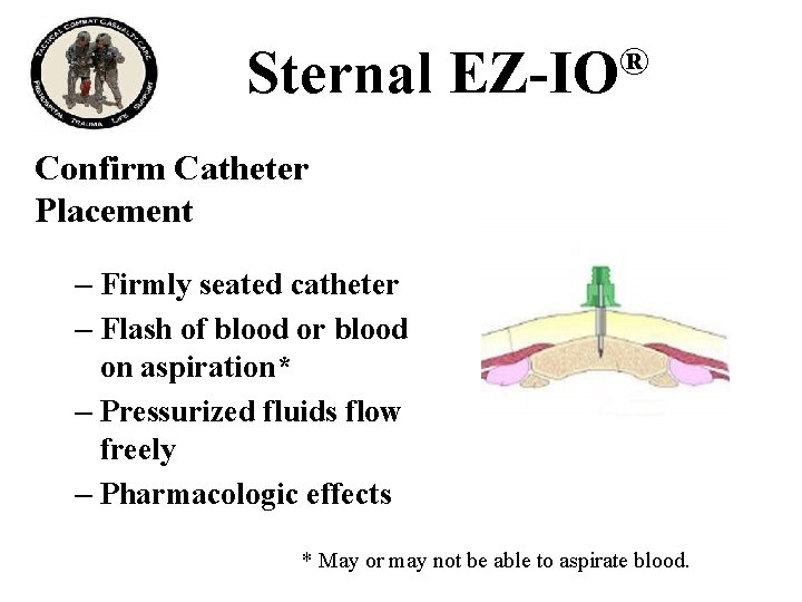 Sternal ® EZ-IO Confirm Catheter Placement – Firmly seated catheter – Flash of blood