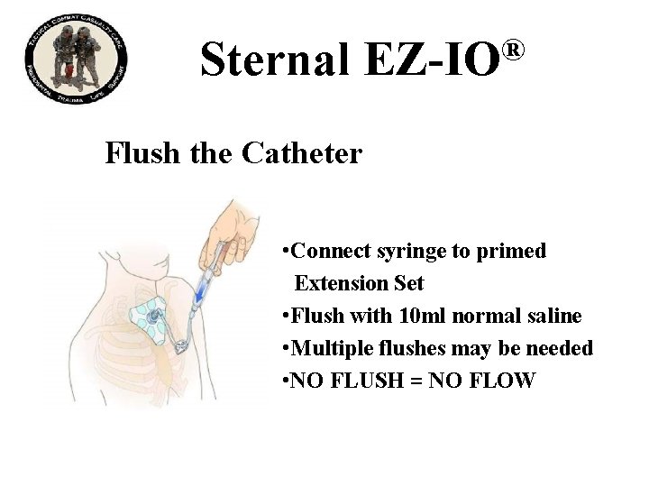 Sternal ® EZ-IO Flush the Catheter • Connect syringe to primed Extension Set •
