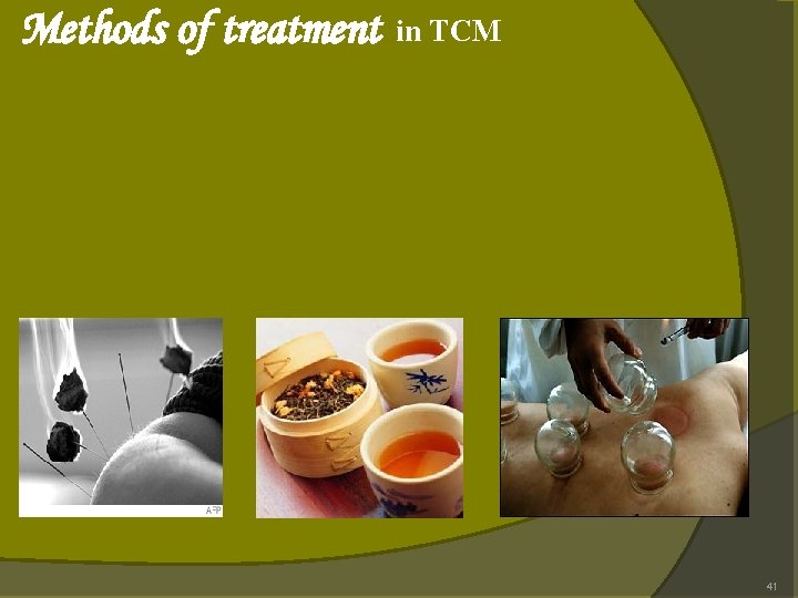 Methods of treatment in TCM 41 Methods of treatment in TCM 41