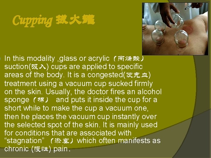 Cupping 拔火罐 In this modality , glass or acrylic(丙烯酸) suction(吸入) cups are applied Cupping 拔火罐 In this modality , glass or acrylic(丙烯酸) suction(吸入) cups are applied