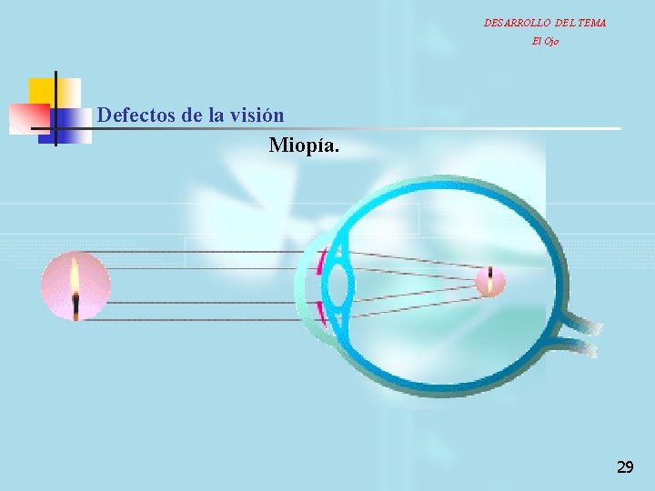 DESARROLLO DEL TEMA El Ojo Defectos de la visión Miopía. 29 