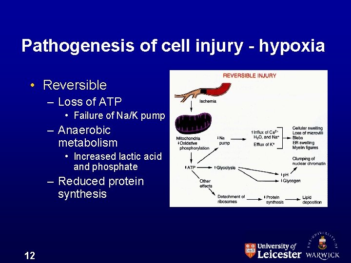 Pathogenesis of cell injury - hypoxia • Reversible – Loss of ATP • Failure