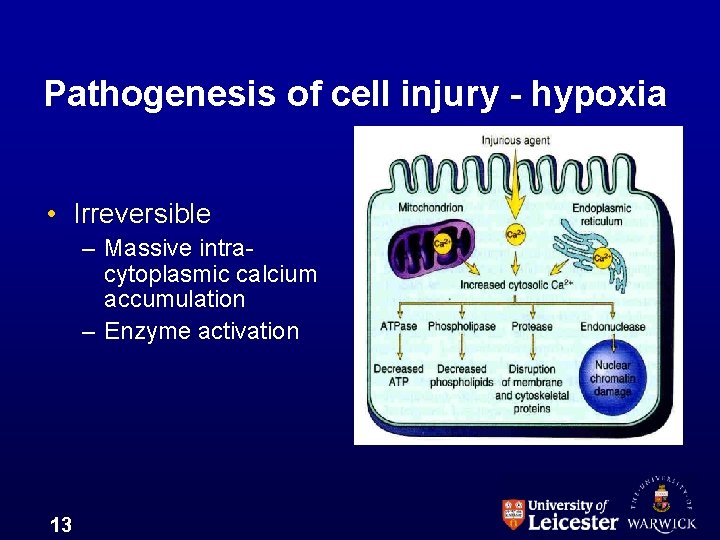 Pathogenesis of cell injury - hypoxia • Irreversible – Massive intracytoplasmic calcium accumulation –