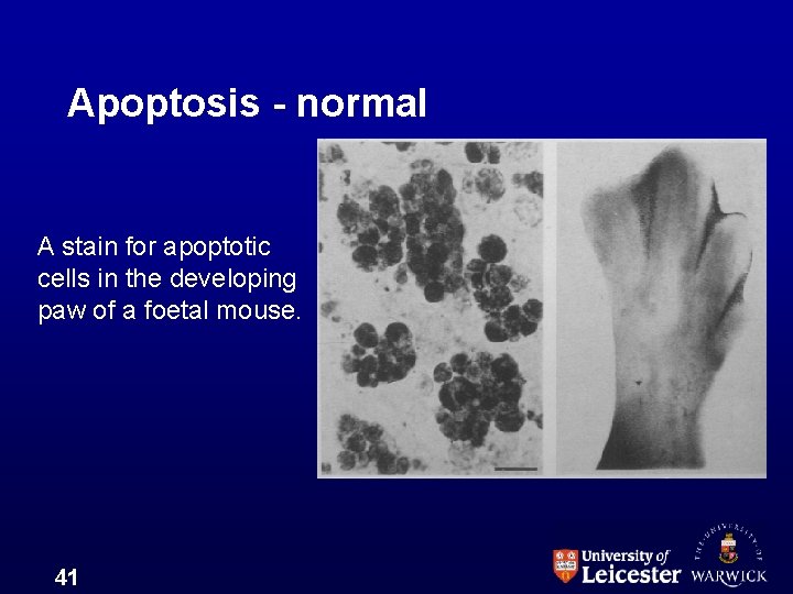 Apoptosis - normal A stain for apoptotic cells in the developing paw of a