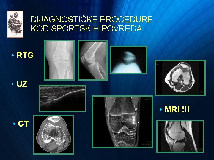 DIJAGNOSTIČKE PROCEDURE KOD SPORTSKIH POVREDA • RTG • UZ • MRI !!! • CT DIJAGNOSTIČKE PROCEDURE KOD SPORTSKIH POVREDA • RTG • UZ • MRI !!! • CT