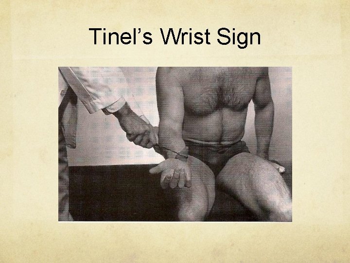 Tinel’s Wrist Sign 