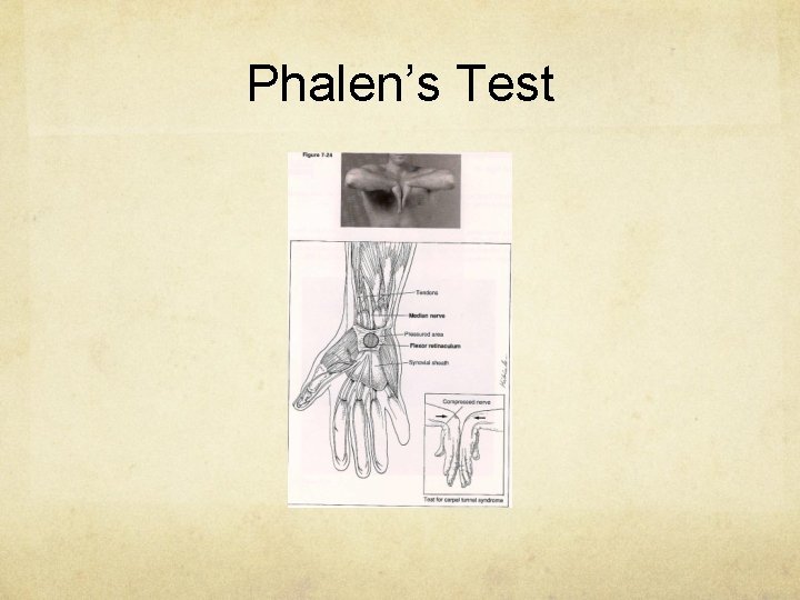Phalen’s Test 
