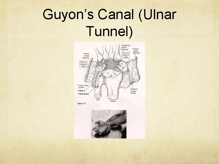 Guyon’s Canal (Ulnar Tunnel) 