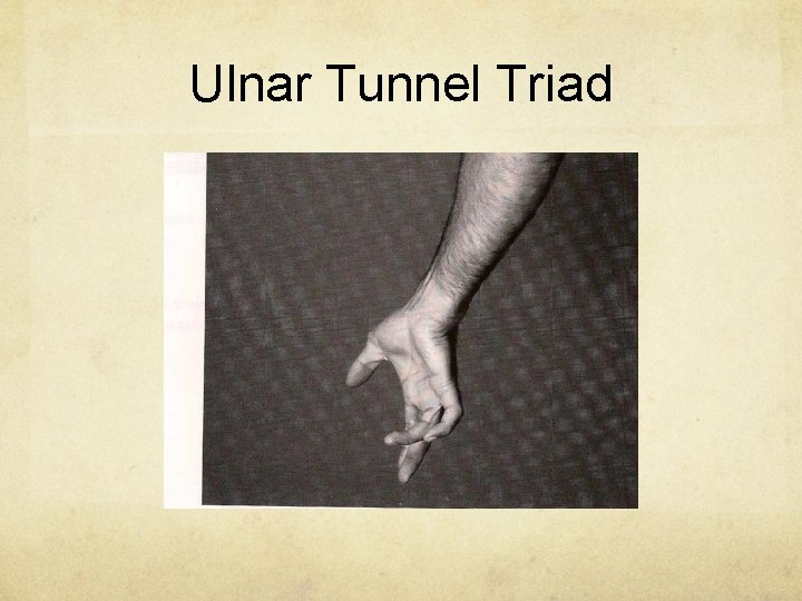 Ulnar Tunnel Triad 