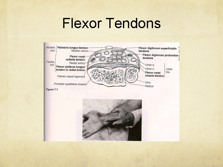 Flexor Tendons 