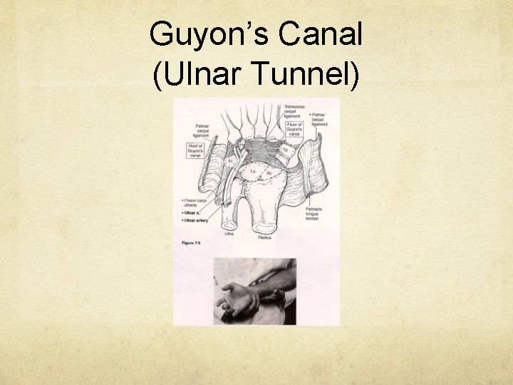 Guyon’s Canal (Ulnar Tunnel) 