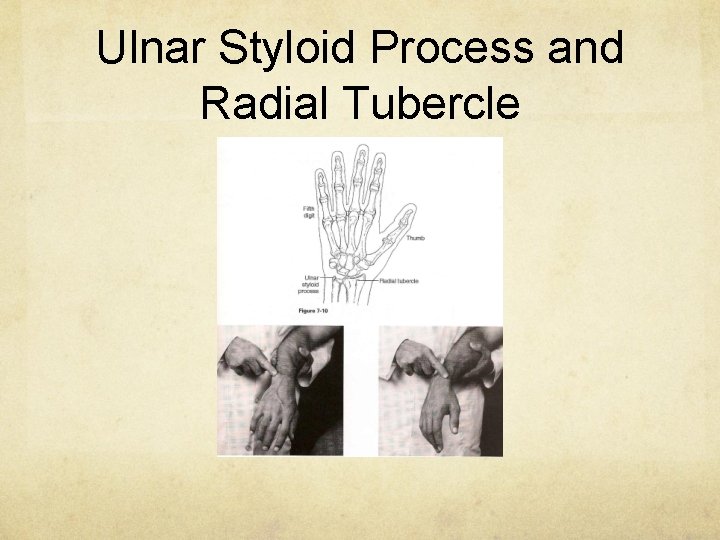 Ulnar Styloid Process and Radial Tubercle 