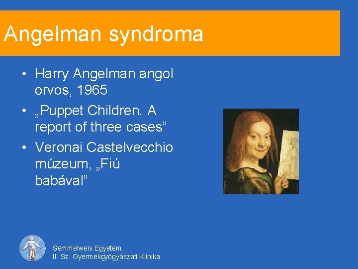 Angelman syndroma • Harry Angelman angol orvos, 1965 • „Puppet Children. A report of