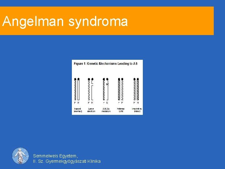 Angelman syndroma Semmelweis Egyetem, II. Sz. Gyermekgyógyászati Klinika 