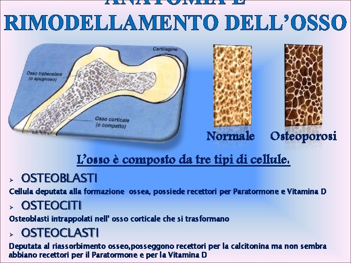ANATOMIA E RIMODELLAMENTO DELL’OSSO Normale Osteoporosi L’osso è composto da tre tipi di cellule:
