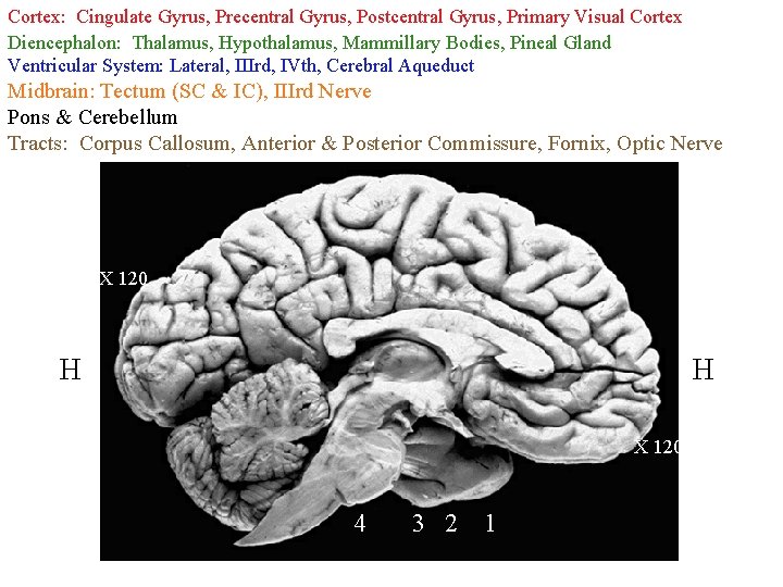 Cortex: Cingulate Gyrus, Precentral Gyrus, Postcentral Gyrus, Primary Visual Cortex Diencephalon: Thalamus, Hypothalamus, Mammillary