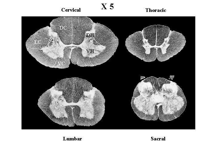 X 5 Cervical Thoracic DC DH LC VH VC Lumbar Sacral 